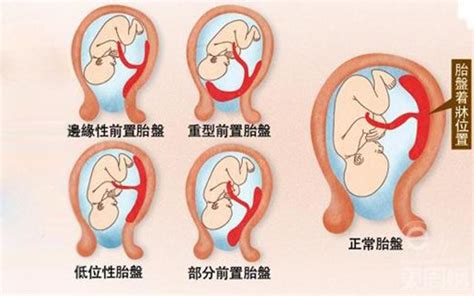 胎盤母體面|胎盤母體面的重要性